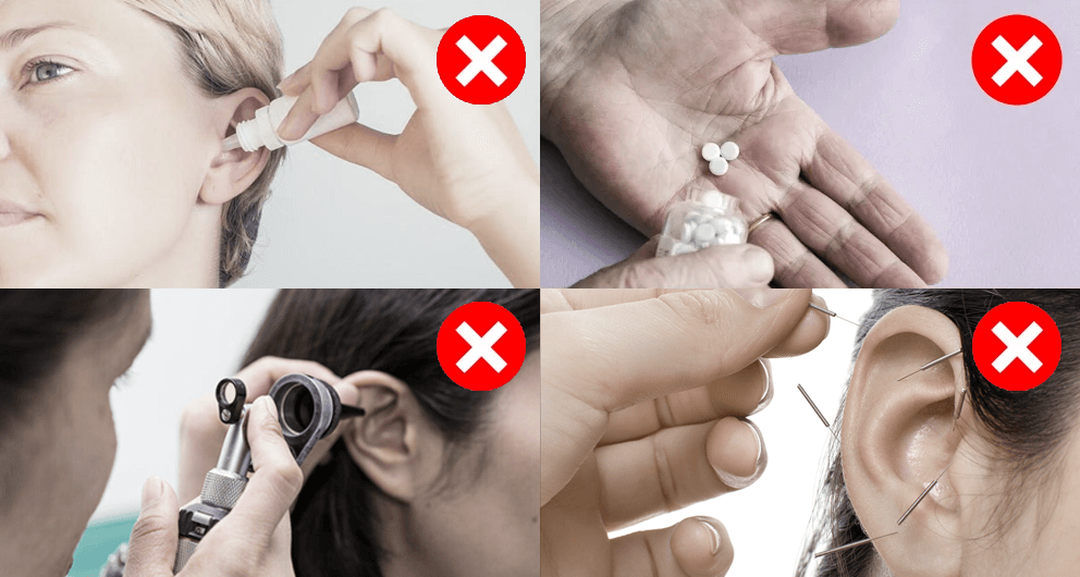 ACUSTAN DÓNDE COMPRAR